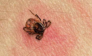 Роспотребнадзор опроверг информацию о случаях анаплазмоза в Подмосковье