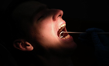 В Подмосковье спасли пациента, проглотившего бур во время лечения зубов