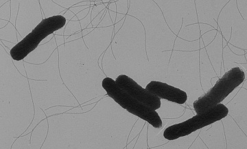 В Забайкалье у 21 вахтовика подтвердили заболевание сальмонеллезом