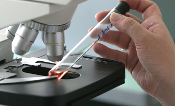 СМИ: установлено, что вирус рыб вызывает серьезные болезни глаз у людей