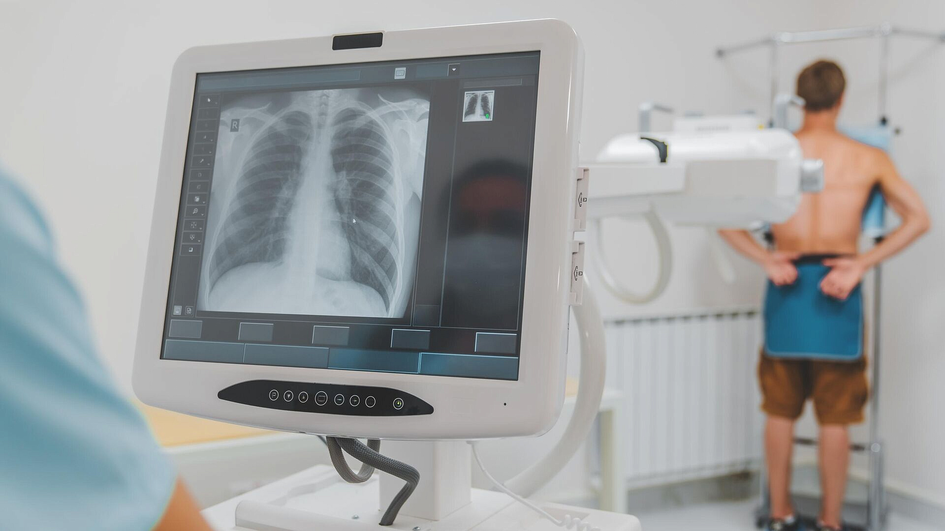 Минздрав разрабатывает новый метод лечения туберкулеза