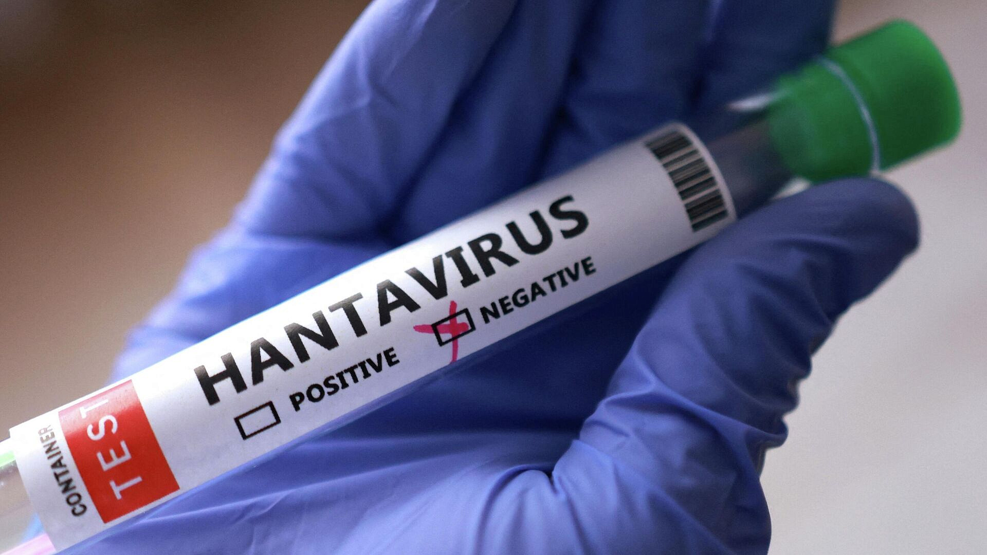 Во Франции примут меры по защите населения от хантавируса