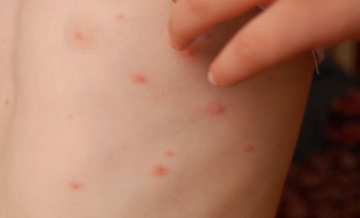 �� ������ ���������������� ����� ������� ��������, �������� ���