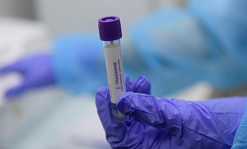 Вариант XFG остается доминирующим штаммом COVID-19 в России