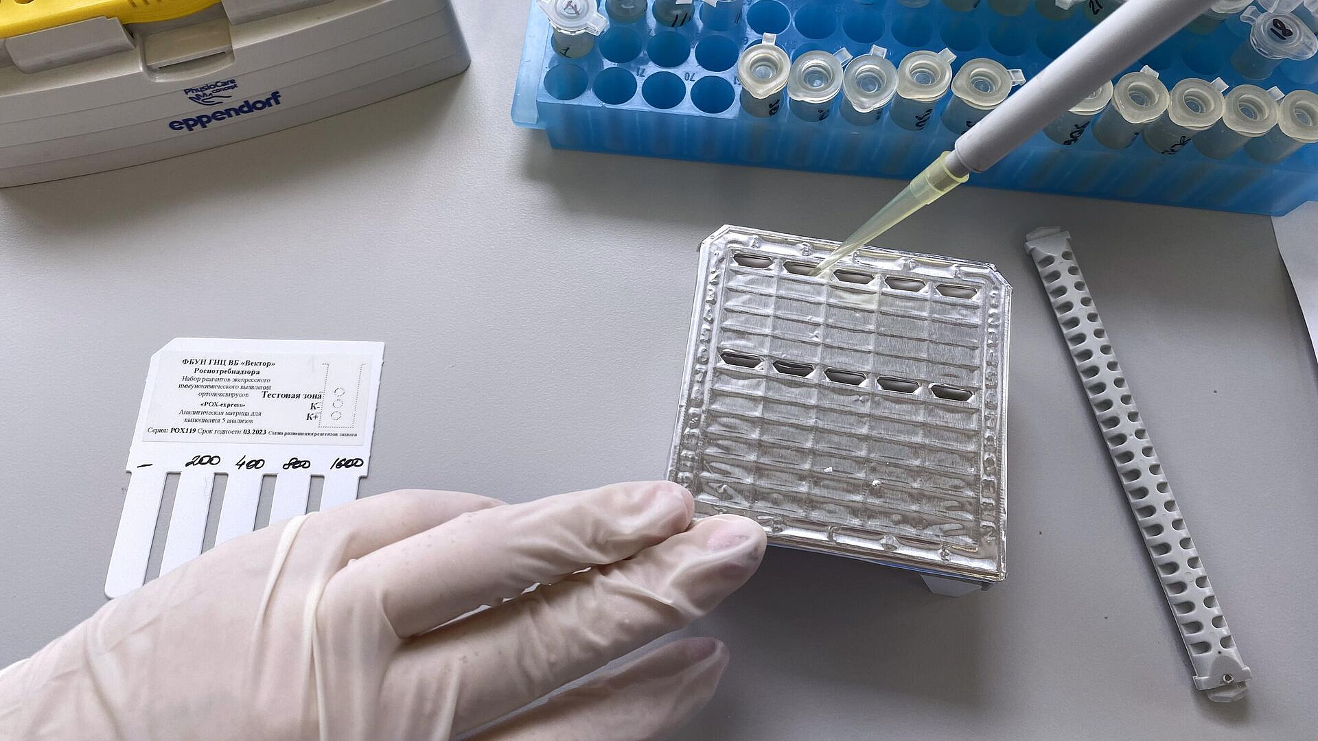 В Роспотребнадзоре рассказали, где можно заразиться оспой обезьян