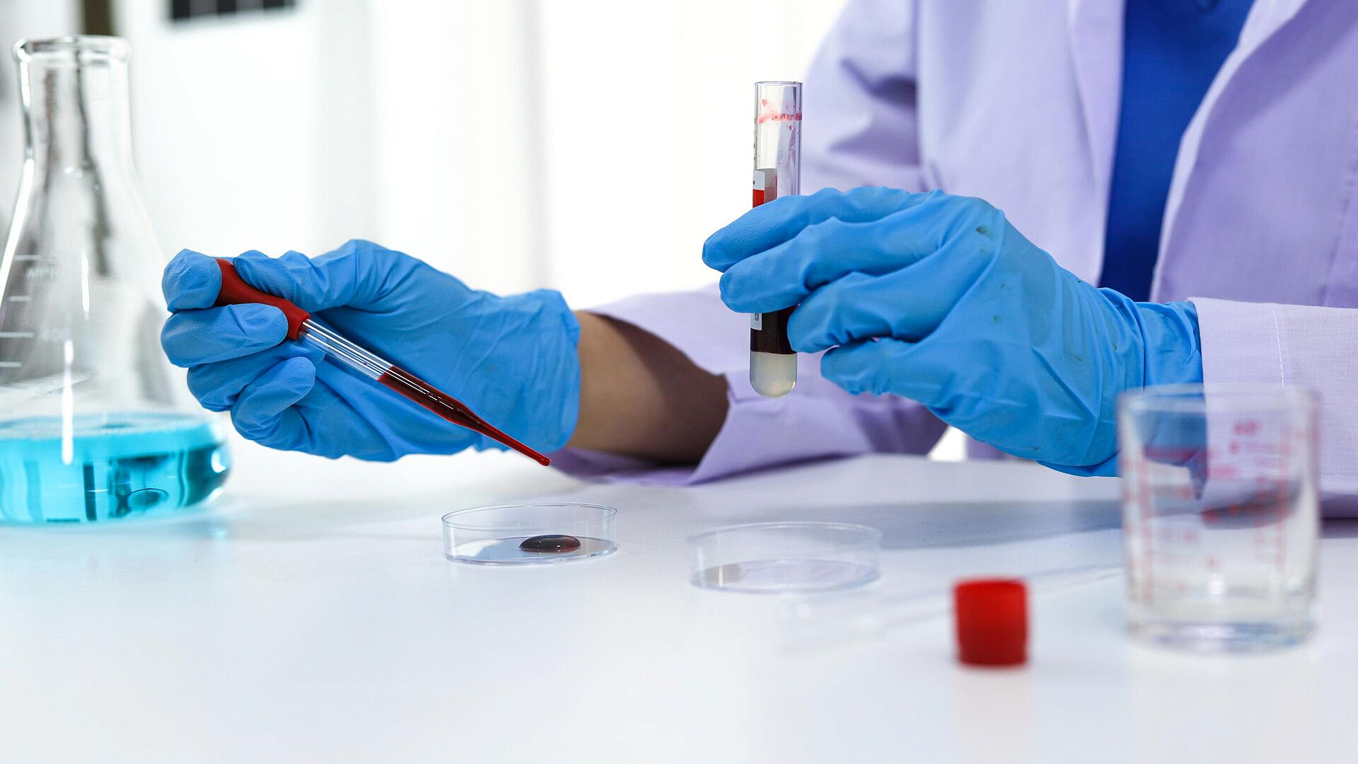 Гематолог назвала симптомы, указывающие на проблемы с кровью