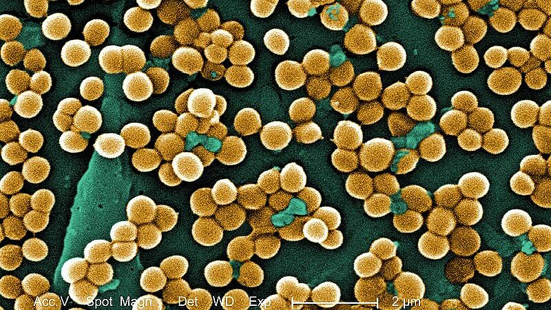 В Красноярске в школе выявили золотистый стафилококк