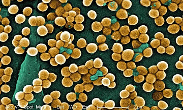 В Красноярске в школе выявили золотистый стафилококк