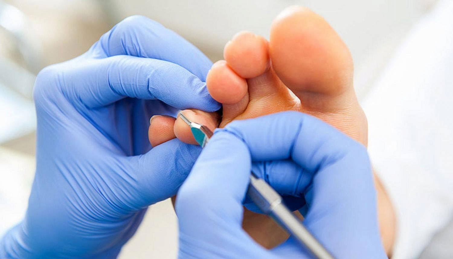 Подология в «ДермаКлиник»: комплексный подход к здоровью ваших стоп