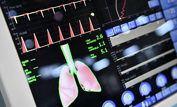 Более 60 аппаратов ИВЛ поступило в медучреждения Подмосковья с начала года