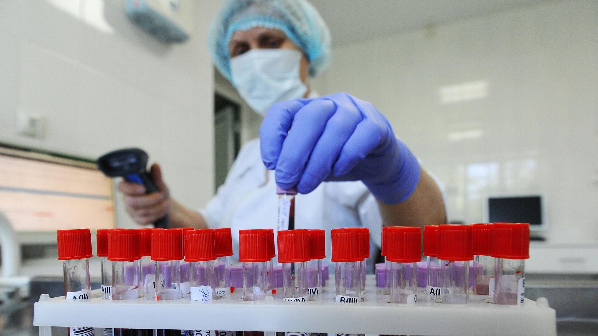 Минздрав сообщил о снижении заболеваемости ВИЧ до исторического минимума