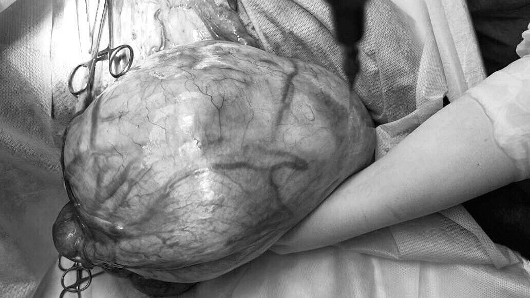 Московские ветеринары удалили у собаки огромную опухоль