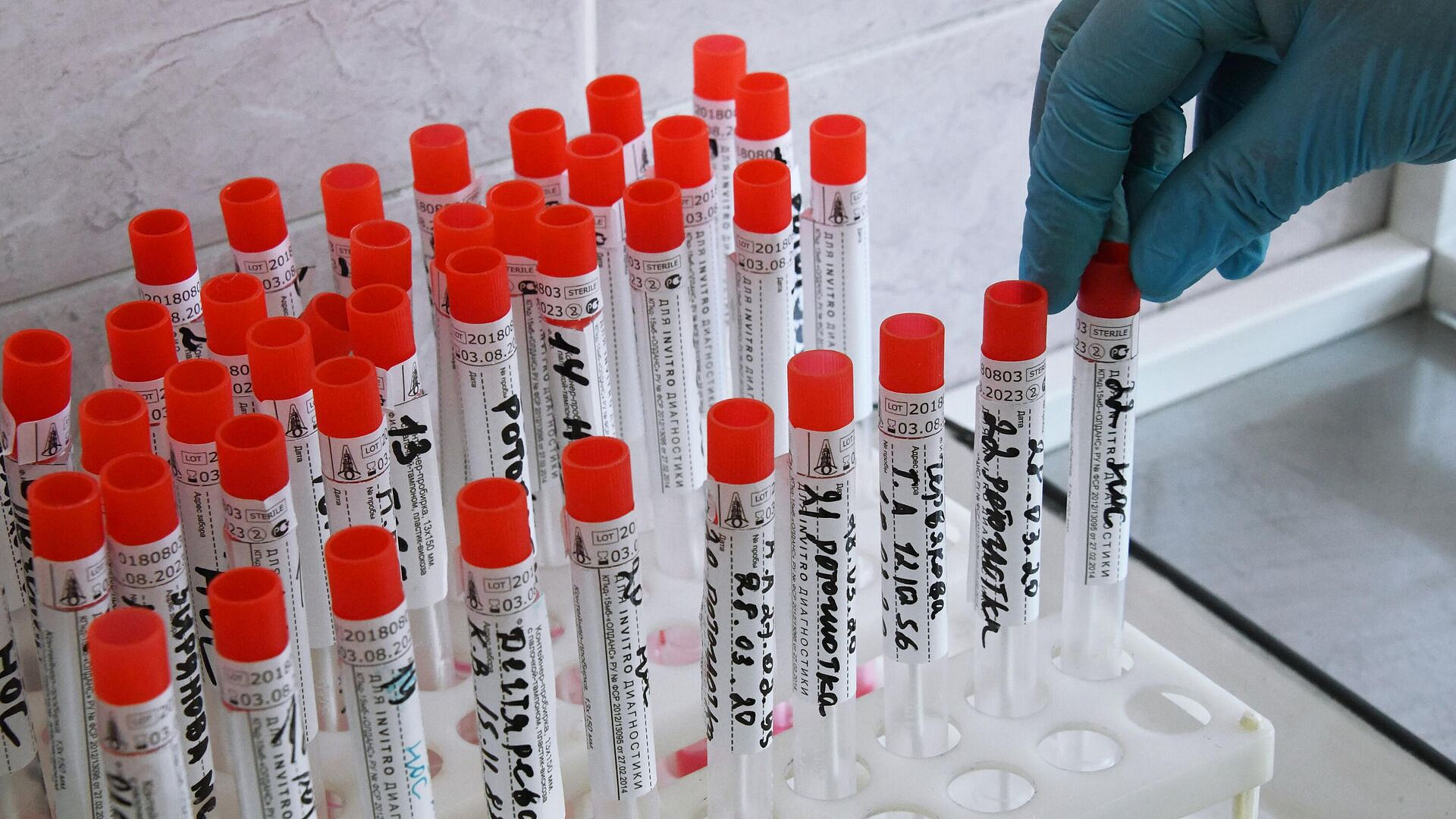 В России зарегистрировали тест на иммунитет к холере