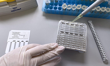 В Домодедовскую больницу госпитализировали двоих пациентов с оспой обезьян