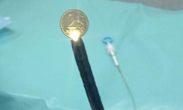 В Подмосковье врачи спасли ребенка, проглотившего монету