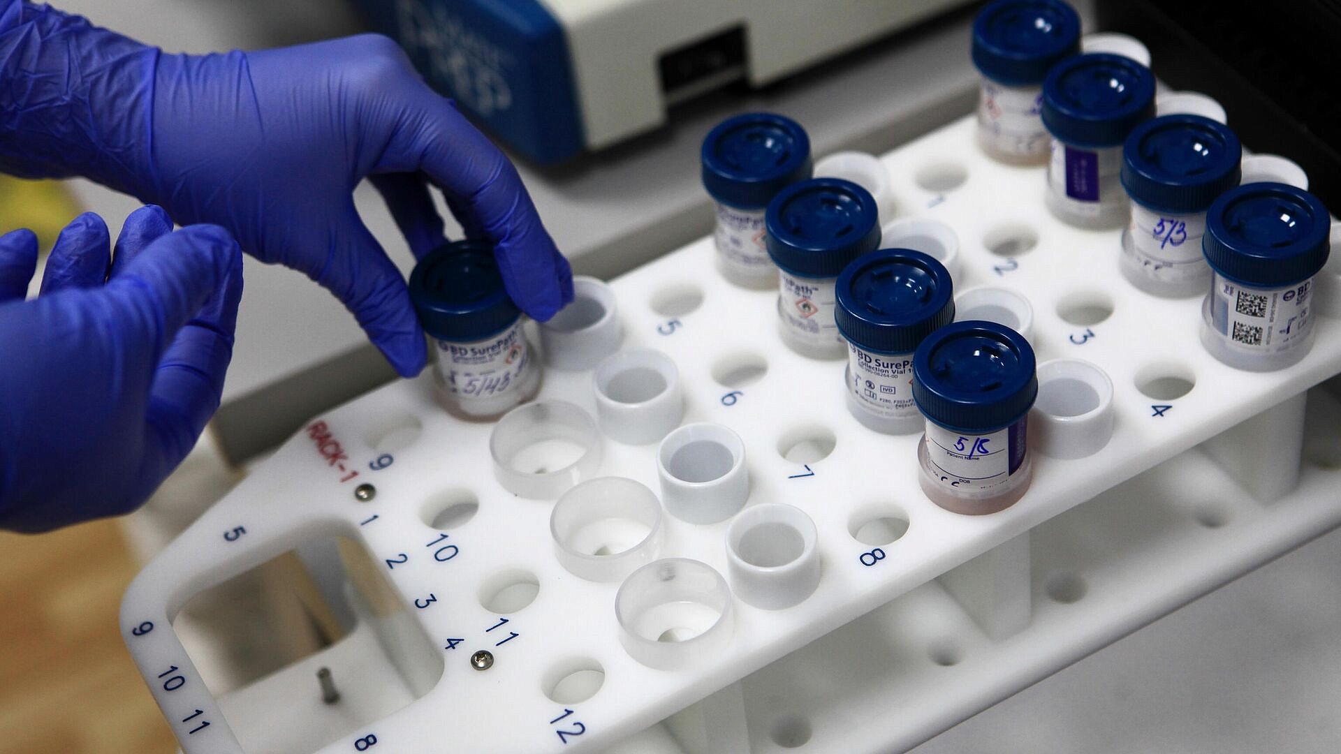 Т-Банк и "Онкологика" изучили, как россияне жертвуют на помощь онкобольным